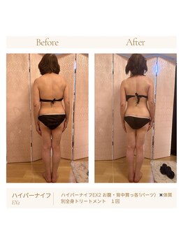 パチュプチ(Patchou petit)/Before→after/痩身