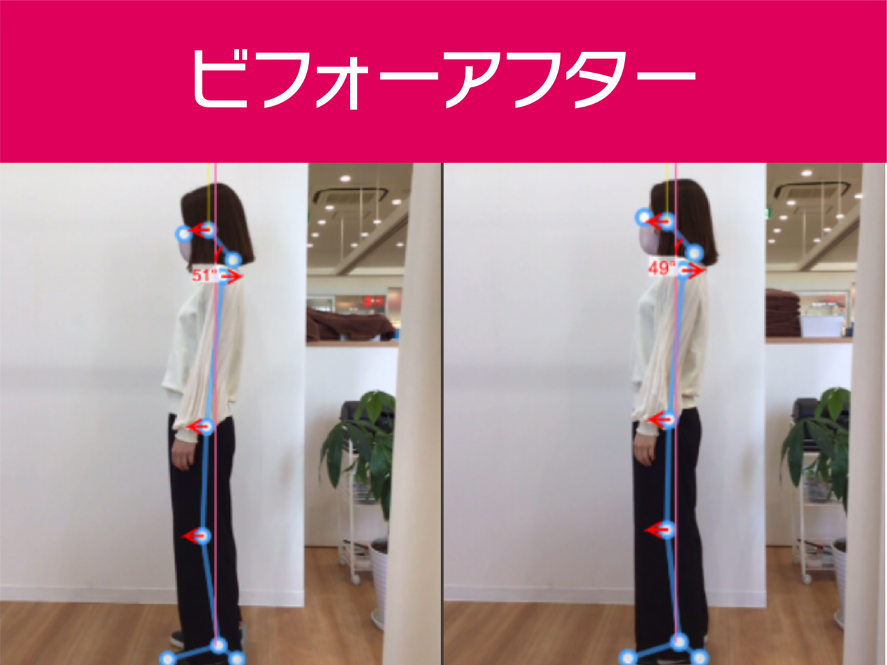 あい鍼灸院 接骨院 東長崎駅前院/ビフォーアフター