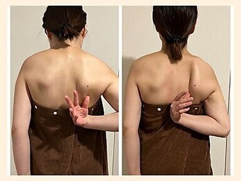 ラフリー 大宮院(RUFFREE)/圧倒的変化を実現【大宮】