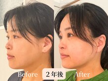 ロシュニ/40代 お悩み:たるみ/首肩こり