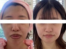 シミケア専門店 SAKURA 平塚店/店内出入り口に検温器設置