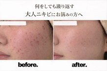 プリベンティブ ビューティー ティップス(Preventive Beauty Tips)
