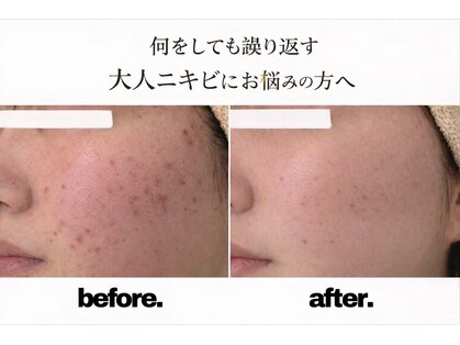 プリベンティブ ビューティー ティップス(Preventive Beauty Tips)の写真