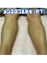 ジョエルワックス 沖縄糸満店(JOELLE WAX)/自己処理不要！