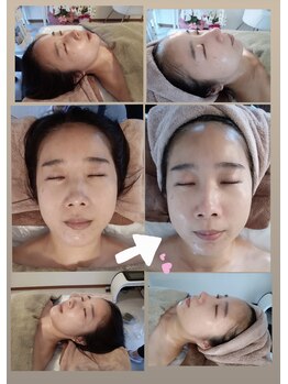 ヒナタ(HINATA)/ツヤツヤ肌はモテる！