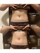 マルレ 三軒茶屋(MARLE)/呼吸が浅くなってませんか？