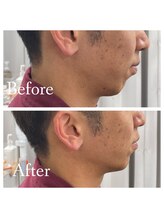 眉ラウンジ 豊田駅前店(眉LOUNGE)/光エステ