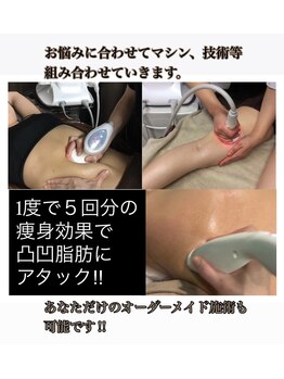 アカツキファイブ(AKATSUKI5)/ボディ【2】