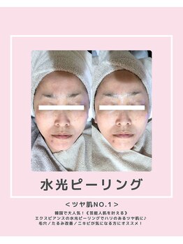 ソワナ(soina)/【神楽坂駅/フェイシャル/毛穴】