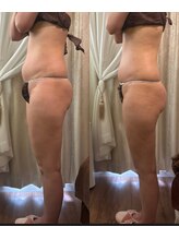 サロンハート(Salon Heart)/