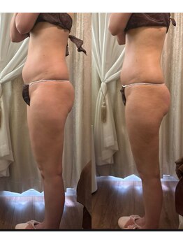 サロンハート(Salon Heart)/