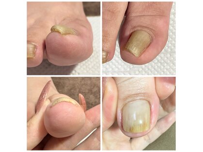 エムネイル(M nail)の写真