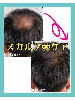 リリベル(LilyBell)/Before After