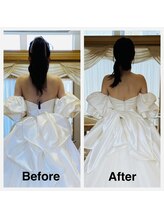 ライズ/お客様のビフォーアフター