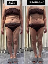 メルシー(Merci)/たった20分でもすっきり！！