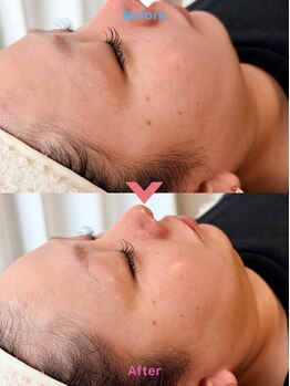 エテル(eter)/PHAピール