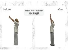 トキ(TOKI)/筋膜リリース美容整体　施術直後