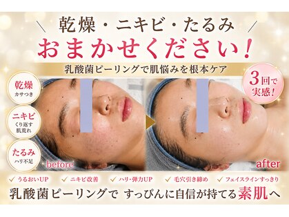 セレブリティ(Celebrity)の写真