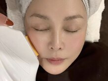 ブレスの雰囲気（最新脱毛器での施術で、一回目で驚きの効果！！）