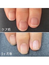 ネイルズ アヴァンティ(Nails Avanti)/地爪育成3ヶ月コース