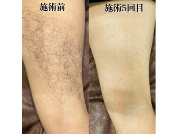 ファブ 川越店/【お客様ビフォーアフター】