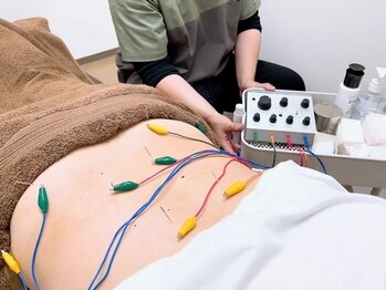 たかさき下小鳥鍼灸 接骨院の写真/【群馬県稀少☆電気を使う鍼施術】施術後の効果に感動！眼精疲労、肩こり、腰痛なんでもお任せ下さい◎