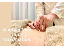 グリーン 京都烏丸店(green)の雰囲気（【鍼灸整体】肩や腰の辛さを鍼によって調えます）