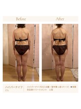 パチュプチ(Patchou petit)/Before→after／痩身