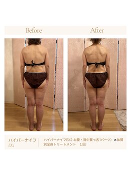 パチュプチ(Patchou petit)/Before→after/痩身