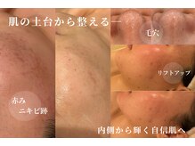 スパレーカ(Spa laka)
