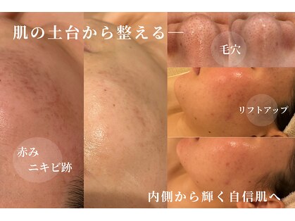 スパレーカ(Spa laka)の写真