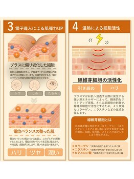 小顔ウナ学芸大学店(UNA)/プラズマ美容マシン効果３・４