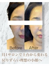 ルミライ(Lumirai)/戻りづらい効果の定着