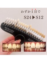 ブリエ(BRILLER)/《医》高効果ホワイトニング症例