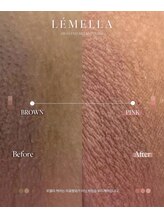 ソレラ(sorelle)/ルメラ