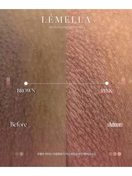 ソレラ(sorelle)/ルメラ