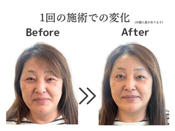 ケー(K)/ビフォーアフター
