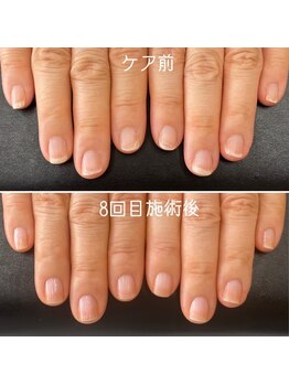 ネイルズ アヴァンティ(Nails Avanti)/地爪育成ネイルケア