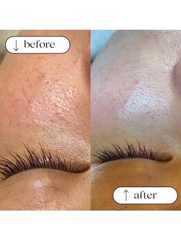 トータルビューティーサロンリア(Li'a)/ビフォー＆アフター