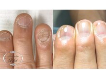 ネイルサロン キュービット(Q-bit)/