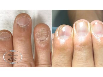 ネイルサロン キュービット(Q-bit)/