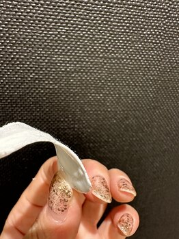 ビューティサロン ダブル 三田店(beauty salon W)/エクソリフト+ワックス脱毛