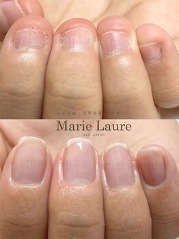 マリーロール 淀屋橋本店(Marie Laure)/自爪育成/深爪矯正/ネイルケア