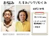 【たるみ/乾燥肌/しわ】 引き上がったぷるぷる肌へ　美容鍼(70本)×超音波　