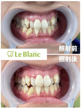 ルブラン 奈良店(Le Blanc)/ご紹介キャンペーンにて