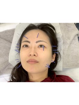 お肌をきれいにしたい