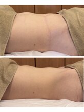 クレアス 勝どき(CREAS)/30代女性腸揉み2回の変化