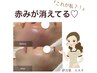 【かゆみ・赤み・ニキビケア】鎮静強化エステ★小顔マッサージ付 ¥11000→