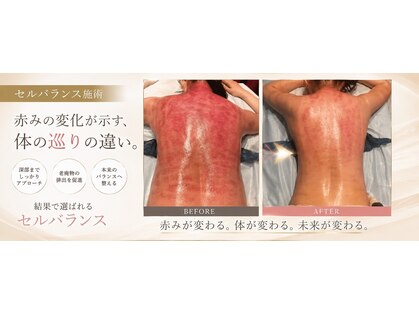 アーネスト(EARNEST)の写真