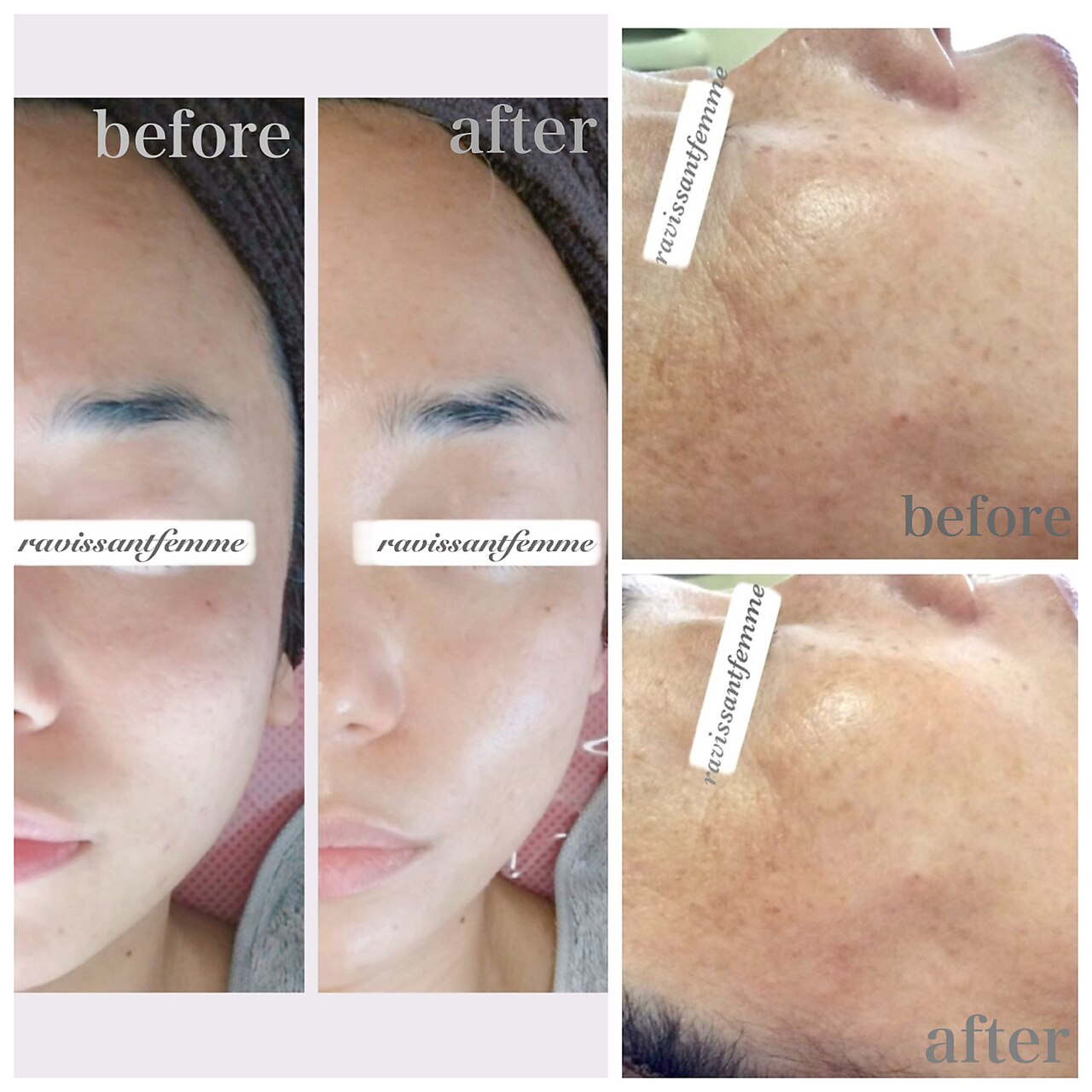 ラヴィソンファム(Ravissant femme)｜ホットペッパービューティー